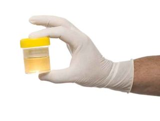 test-urine.jpg